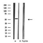 Carboxypeptidase M Antibody in Western Blot (WB)