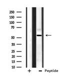 CPN2 Antibody in Western Blot (WB)