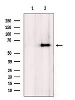 CPN2 Antibody in Western Blot (WB)