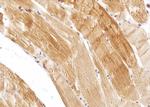 CPT1B Polyclonal Antibody