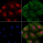 CEP57 Antibody in Immunocytochemistry (ICC/IF)