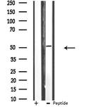Cerebral Protein 1 Antibody in Western Blot (WB)