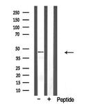 CLN5 Antibody in Western Blot (WB)