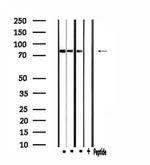 CLCN4 Polyclonal Antibody