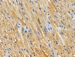 CHSY1 Polyclonal Antibody
