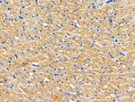 CHSY1 Antibody in Immunohistochemistry (Paraffin) (IHC (P))