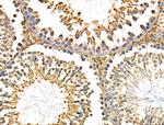 CHSY1 Antibody in Immunohistochemistry (Paraffin) (IHC (P))