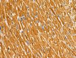 CMTM2 Polyclonal Antibody
