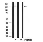 CLASP1 Polyclonal Antibody