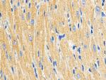 C1QC Polyclonal Antibody