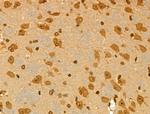 PRIM1 Polyclonal Antibody