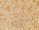 PRIM1 Antibody in Immunohistochemistry (Paraffin) (IHC (P))