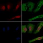 RNF111 Polyclonal Antibody
