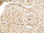 RFWD2 Antibody in Immunohistochemistry (Paraffin) (IHC (P))