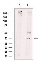 RNF144B Polyclonal Antibody
