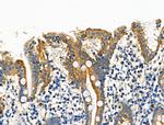 eIF5B Antibody in Immunohistochemistry (Paraffin) (IHC (P))