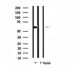hnRNP LL Antibody in Western Blot (WB)