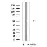 LRP11 Antibody in Western Blot (WB)