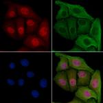 MAD2L1BP Polyclonal Antibody