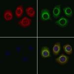 MBL2 Polyclonal Antibody