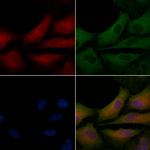 MGST2 Polyclonal Antibody