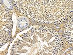 MRPL3 Antibody in Immunohistochemistry (Paraffin) (IHC (P))