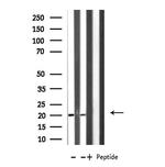 MRPL49 Antibody in Western Blot (WB)
