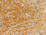 SLC16A13 Polyclonal Antibody