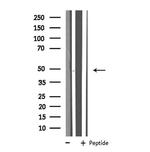 SLC16A14 Antibody in Western Blot (WB)