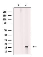 Myoglobin Polyclonal Antibody