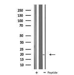 Myoglobin Antibody in Western Blot (WB)