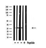 NDUFV2 Antibody in Western Blot (WB)