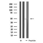 NLE1 Antibody in Western Blot (WB)