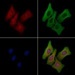NOLC1 Polyclonal Antibody