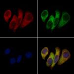 KCNK6 Polyclonal Antibody