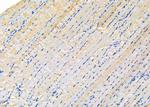 KCNK7 Polyclonal Antibody