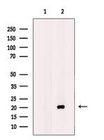 BTC Polyclonal Antibody