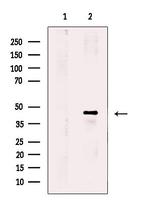 PPM1L Polyclonal Antibody