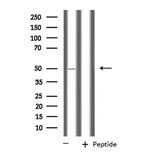 PPM1L Antibody in Western Blot (WB)