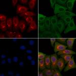 PMS2/PMS2CL Polyclonal Antibody