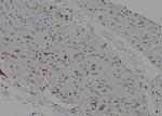 PMS2/PMS2CL Antibody in Immunohistochemistry (Paraffin) (IHC (P))