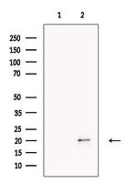 PMS2/PMS2CL Antibody in Western Blot (WB)