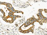 MOV10L1 Antibody in Immunohistochemistry (Paraffin) (IHC (P))