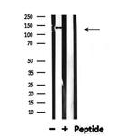 MOV10L1 Antibody in Western Blot (WB)