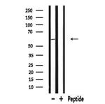 RAB11FIP2 Polyclonal Antibody