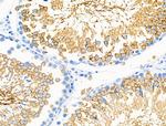 RAP1GAP Antibody in Immunohistochemistry (Paraffin) (IHC (P))
