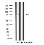 RAP1GAP Antibody in Western Blot (WB)