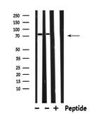 RAP1GAP Antibody in Western Blot (WB)