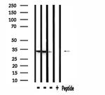 RAB40B Polyclonal Antibody