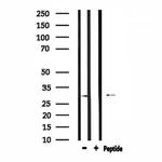 RAB29 Polyclonal Antibody